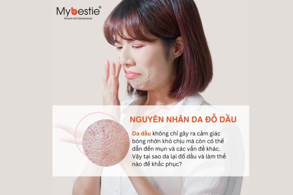 Những Nguyên Nhân Khiến Da Đổ Dầu